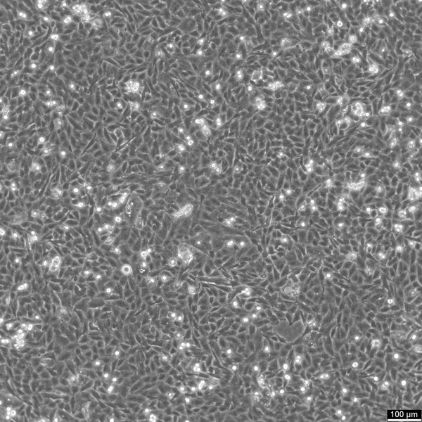 PATU8988T cell