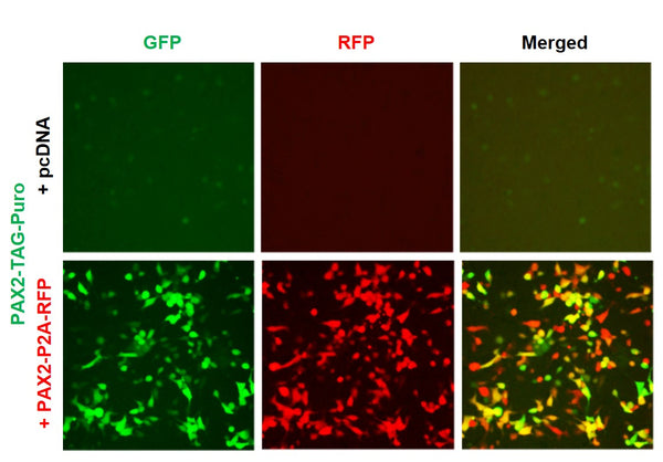 PAX2 Reporter Lentivirus – Figure 1 of 7