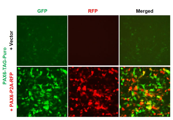 PAX6 Reporter Lentivirus – Figure 1