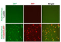 PAX8 Reporter Lentivirus – Figure 1 of 8
