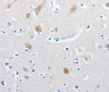MATN1 Polyclonal Antibody – Figure 1 of 3