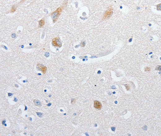 MATN1 Polyclonal Antibody – Figure 1 of 3