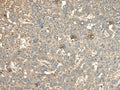 CA11 Polyclonal Antibody – Figure 1 of 2