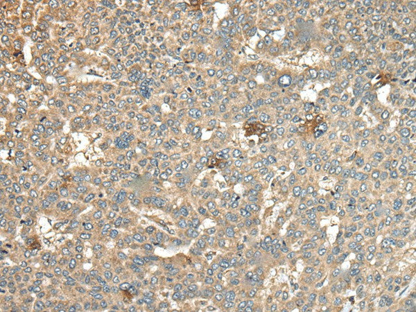 CA11 Polyclonal Antibody – Figure 1 of 2