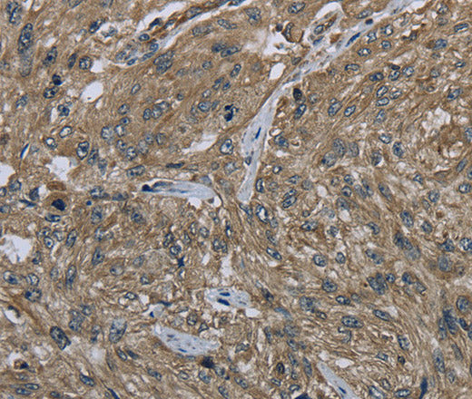 CLPS Polyclonal Antibody – Figure 1 of 3