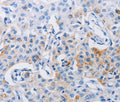 LRIG1 Polyclonal Antibody – Figure 1 of 2