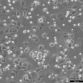 PLC/PRF/5 cell