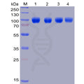 Human SIRPa Protein, hFc-His Tag – Figure 1 of 1