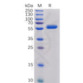 Human CTLA-4 Protein, mFc-His Tag – Figure 1 of 1