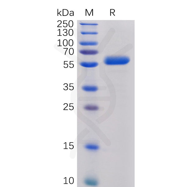 Human CTLA-4 Protein, mFc-His Tag – Figure 1 of 1