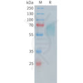 Human CD30 Protein, His tag – Figure 1 of 1