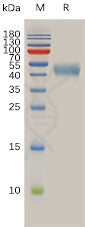 Human SSTR2 Protein, hFc Tag – Figure 1 of 1