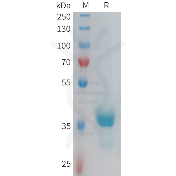 Human CX3CR1 Protein, hFc Tag – Figure 1 of 1