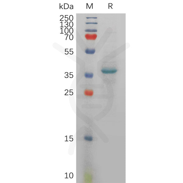 Human CXCL12 Protein, hFc Tag – Figure 1 of 1