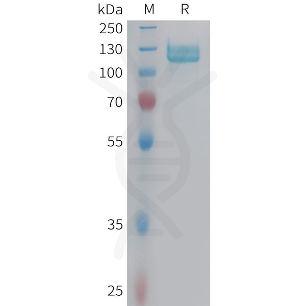 Human ITGB5 Protein, hFc Tag – Figure 1 of 1
