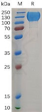 Human MERTK Protein, hFc Tag – Figure 1 of 1