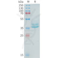 Human ADAM17(581-642) Protein, hFc Tag – Figure 1 of 1