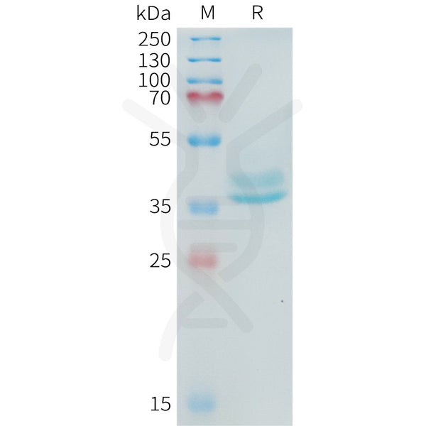 Human ADAM17(581-642) Protein, hFc Tag – Figure 1 of 1