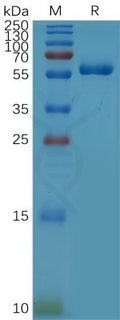 Human CD32a (R167) Protein, hFc Tag – Figure 1 of 1