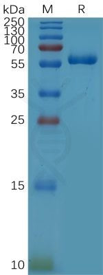 Human CD32a (R167) Protein, hFc Tag – Figure 1 of 1
