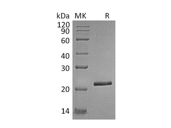 Recombinant Human TIMP-4/TIMP4 Protein (His Tag) – Figure 1 of 2