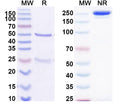 SDS-PAGE for Anti-Bet v 1/Allergen Bet v I-A Antibody (SAA0658)