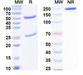 SDS-PAGE for Anti-Bet v 1/Allergen Bet v I-A Antibody (SAA0662)