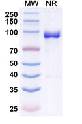 SDS-PAGE for Anti-Bet v 1/Allergen Bet v I-A Antibody (SAA0666).