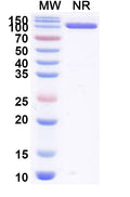 SDS-PAGE for Anti-Bet v 1/Allergen Bet v I-A Antibody (SAA0667).