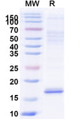 SDS-PAGE for Anti-Castor bean Ricin Nanobody (SAA0991)