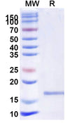 SDS-PAGE for Anti-Castor bean Ricin Nanobody (SAA1088)