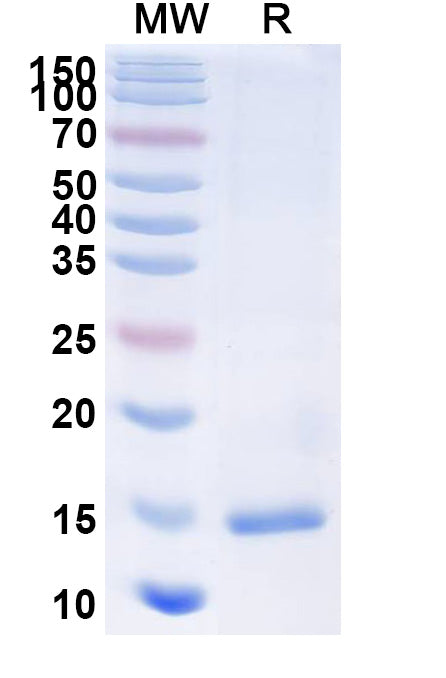 SDS-PAGE for Anti-Castor bean Ricin Nanobody (SAA1097)