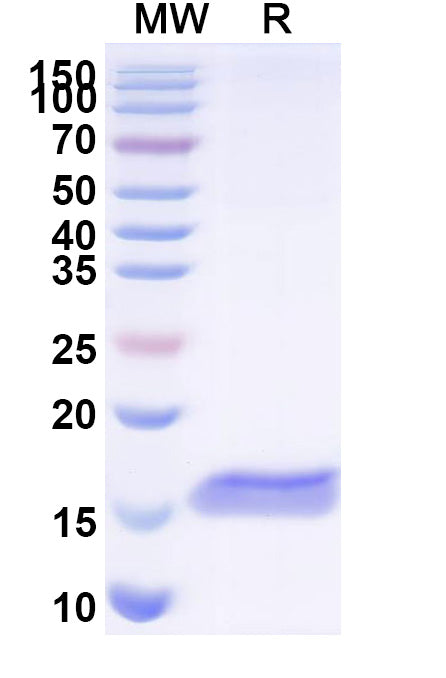 SDS-PAGE for Anti-Castor bean Ricin Nanobody (SAA1126)