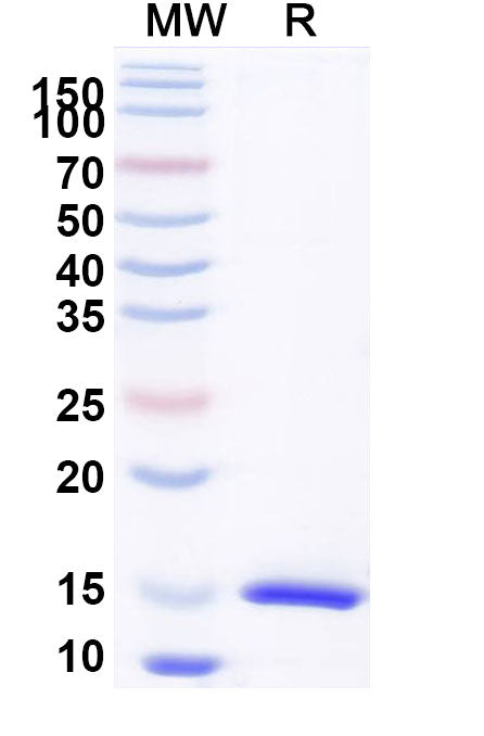 SDS-PAGE for Anti-Castor bean Ricin Nanobody (SAA1142)