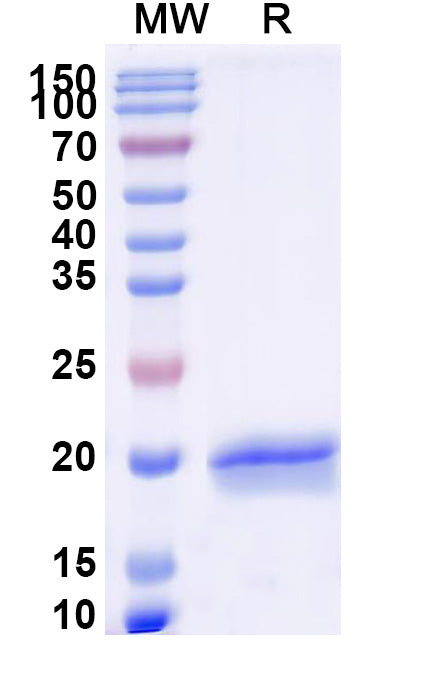 SDS-PAGE for Anti-Castor bean Ricin Nanobody (SAA1143)