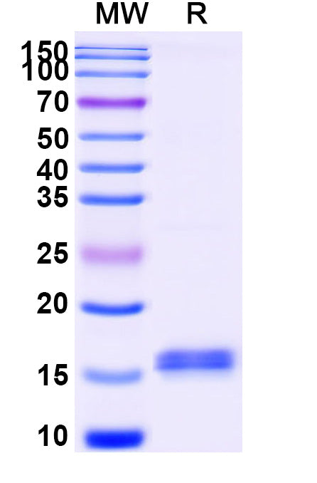 SDS-PAGE for Anti-Castor bean Ricin Nanobody (SAA1149)