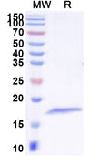 SDS-PAGE for Anti-Common timothy PHLPIV/Phl p 4 Nanobody (SAA2272)