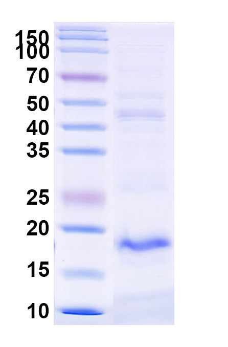 SDS-PAGE for Anti-Common timothy PHLPVI/Phl p 6 Nanobody (SAA2274)