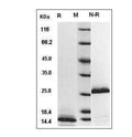 Human TGF-?1 protein