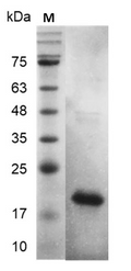 Human FGF-1/aFGF Protein, His tag (Animal-Free)