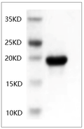 Human IL-6 Protein