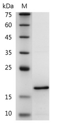 Human FGF-6 Protein, His tag (Animal-Free)