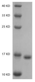 Human IL-36? Protein