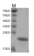 Human FGF 21 Protein