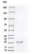 Human Sonic Hedgehog Protein
