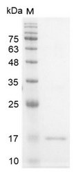 Human IFN-? protein, His tag (Animal-Free)