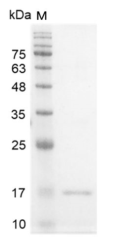 Human IFN-? protein, His tag (Animal-Free)
