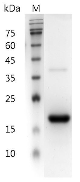 Human IFN-?1a protein, His tag (Animal-Free)