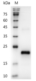 Human VEGF165 protein, His tag (Animal-Free)
