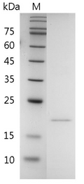 Human RANKL Protein, His tag (Animal-Free)